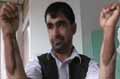 Military Captain of Afghanistan Gets Indian Hands Transplant